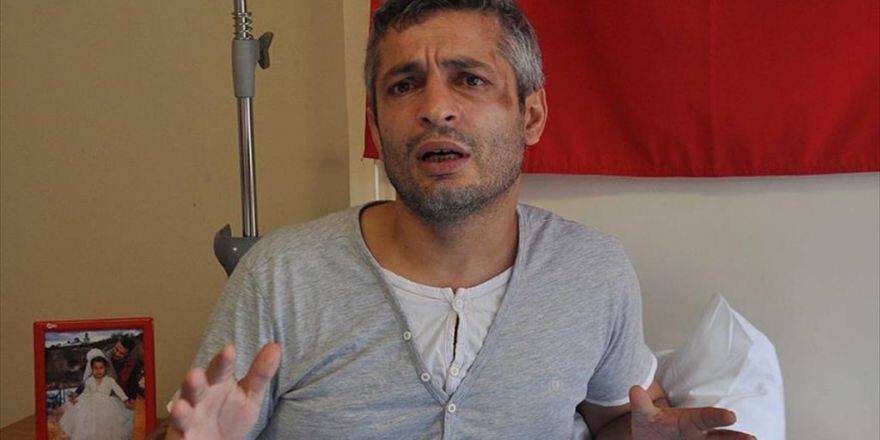 Başındaki Mermi Parçaları Darbe Girişimini Unutturmayacak