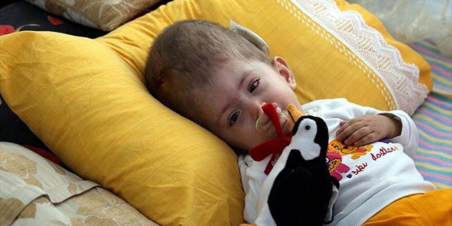 Hidrosefali Hastası Ümmügülsüm Ameliyat İçin Yardım Bekliyor