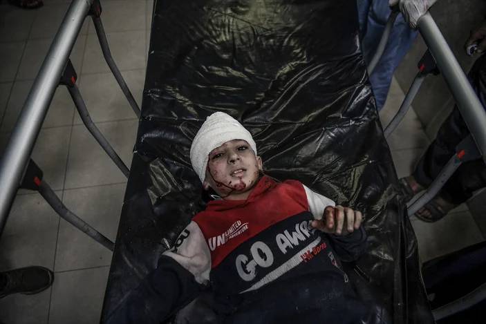 Gazze'deki katliamın yürek kaldırmayacak görüntüleri 30