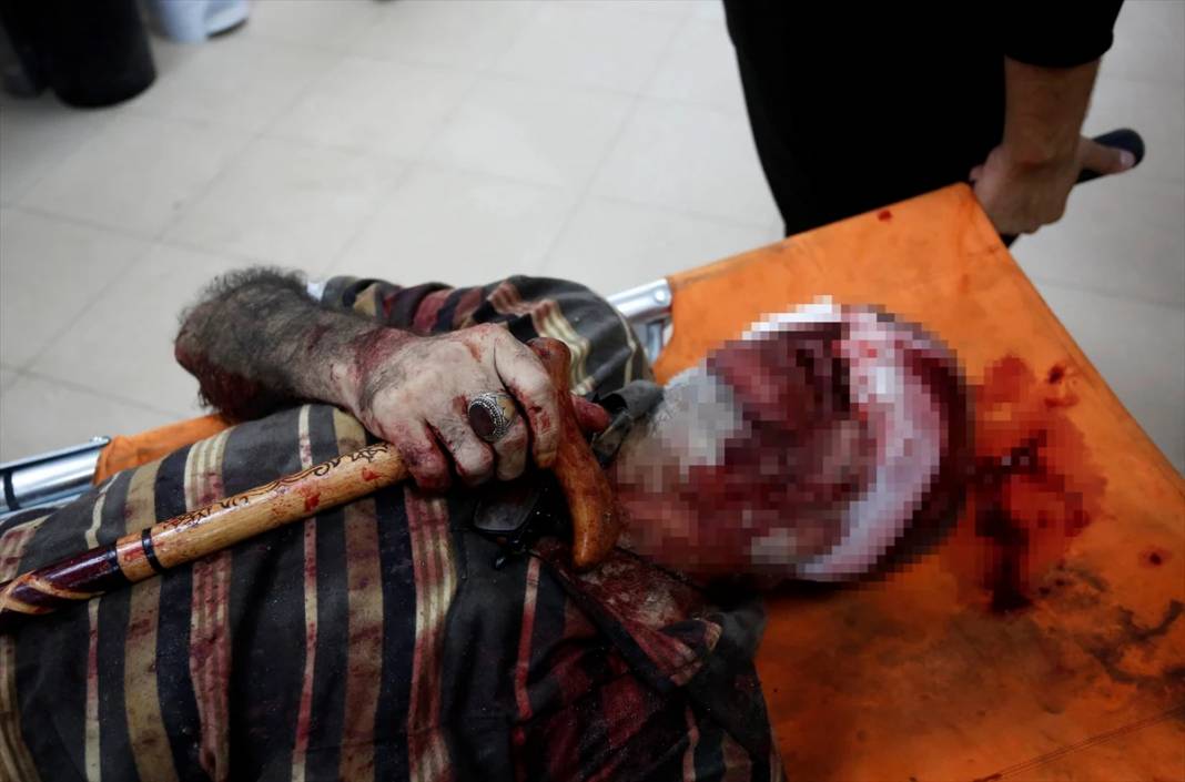 Gazze'deki katliamın yürek kaldırmayacak görüntüleri 25