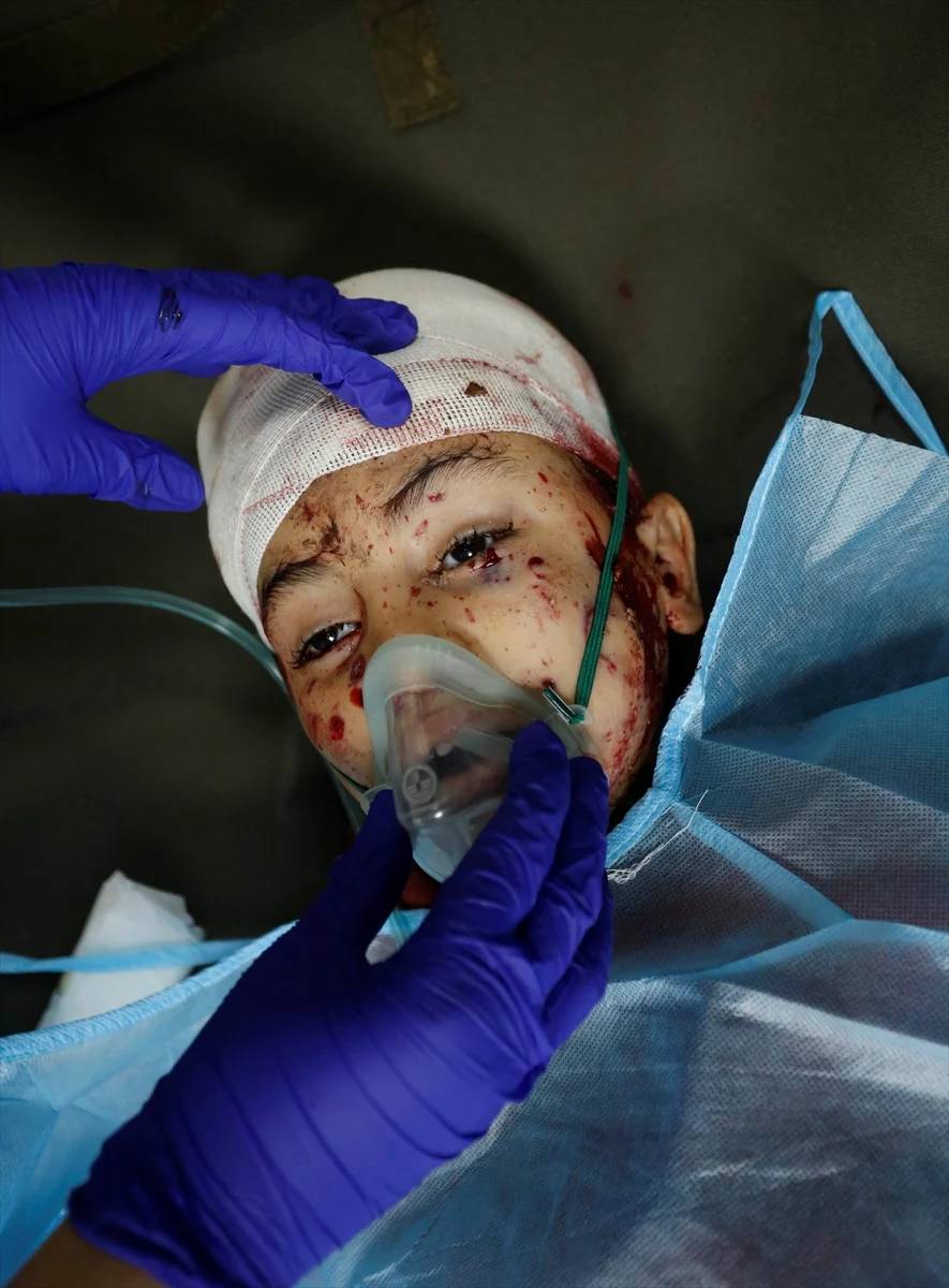 Gazze'deki katliamın yürek kaldırmayacak görüntüleri 24