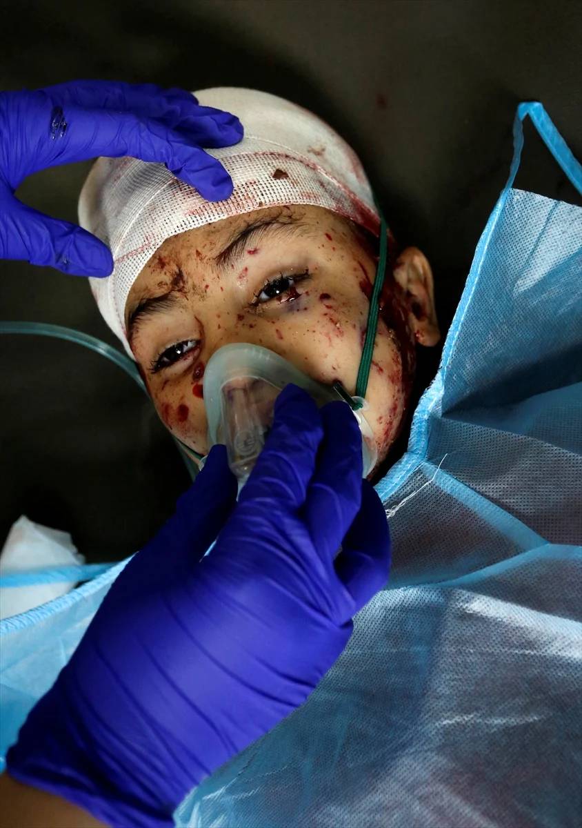 Gazze'deki katliamın yürek kaldırmayacak görüntüleri 21