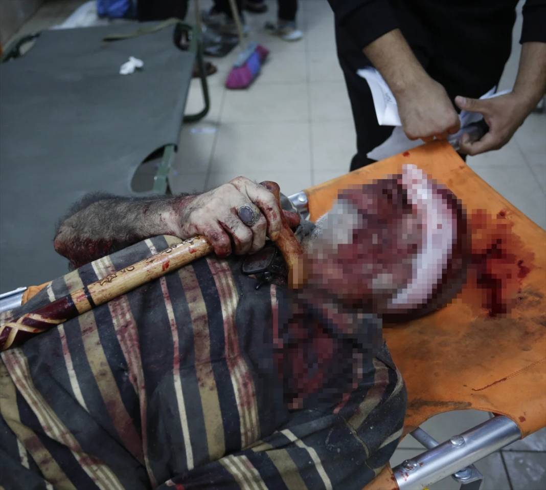 Gazze'deki katliamın yürek kaldırmayacak görüntüleri 20
