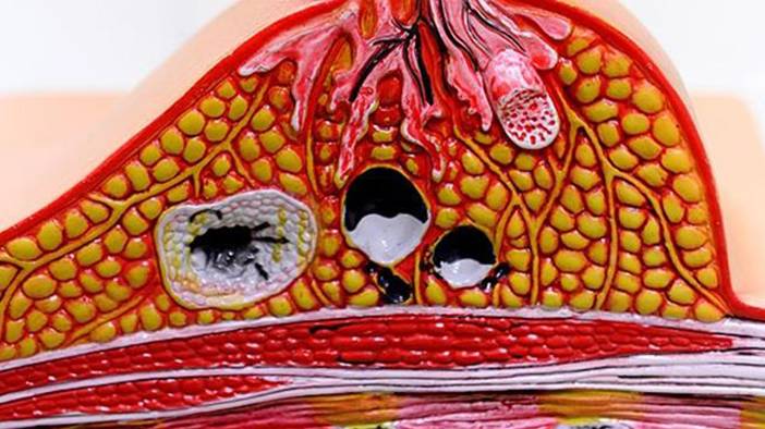'Günde bir tane yiyen doktorun yolunu unutur' sözü doğru mu? İşte araştırma sonuçları 3