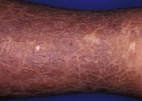 Cildin gençliğini korumak için 4 altın kural 2