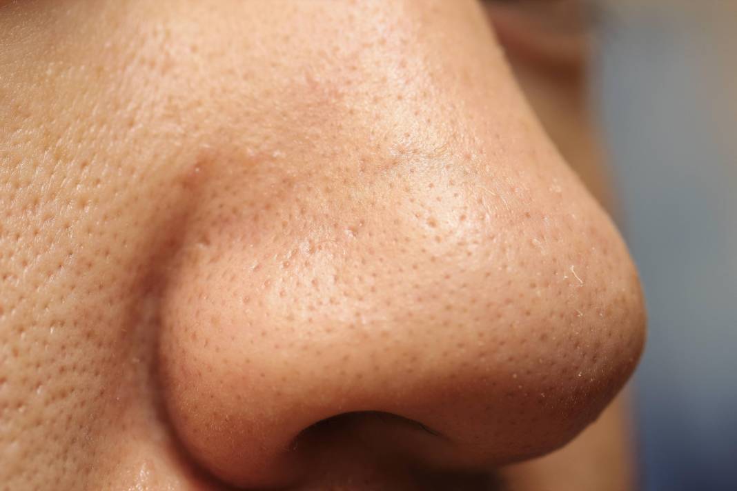 Tüyler neden diken diken olur? İşte tıbbi açıklaması 10