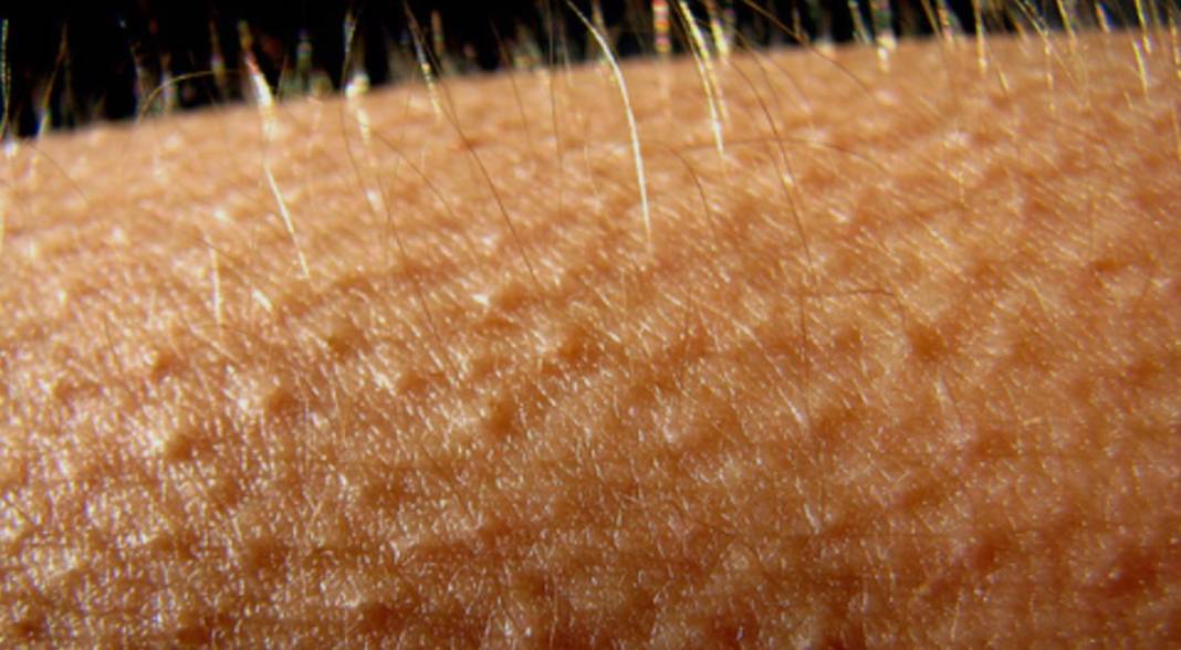 Tüyler neden diken diken olur? İşte tıbbi açıklaması 2