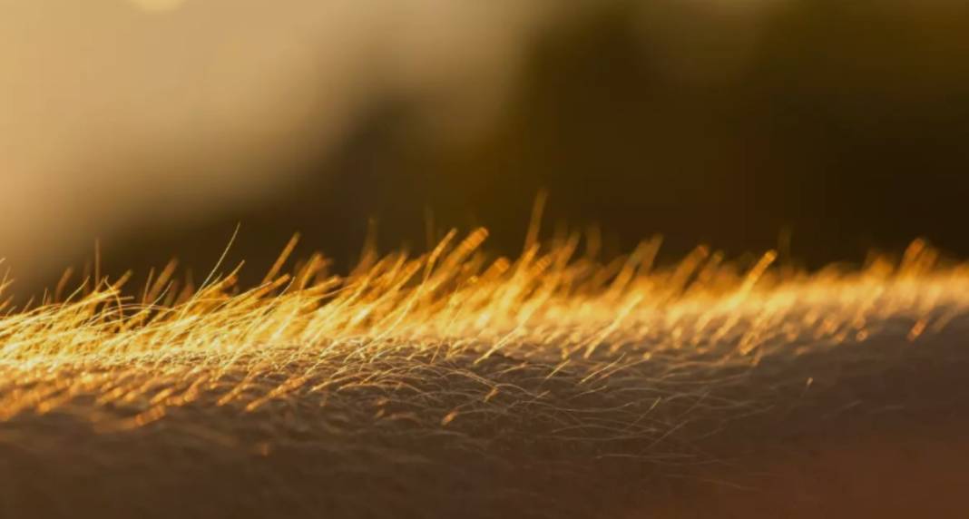 Tüyler neden diken diken olur? İşte tıbbi açıklaması 12