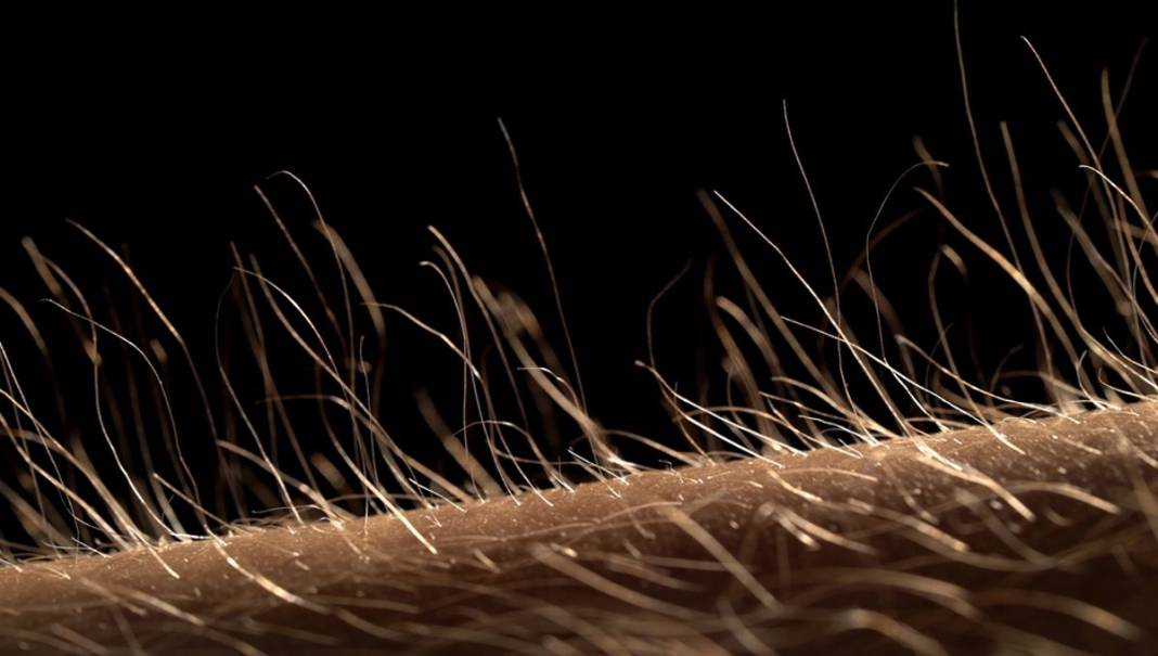 Tüyler neden diken diken olur? İşte tıbbi açıklaması 1