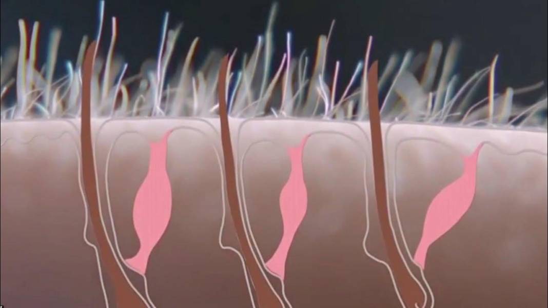 Tüyler neden diken diken olur? İşte tıbbi açıklaması 6