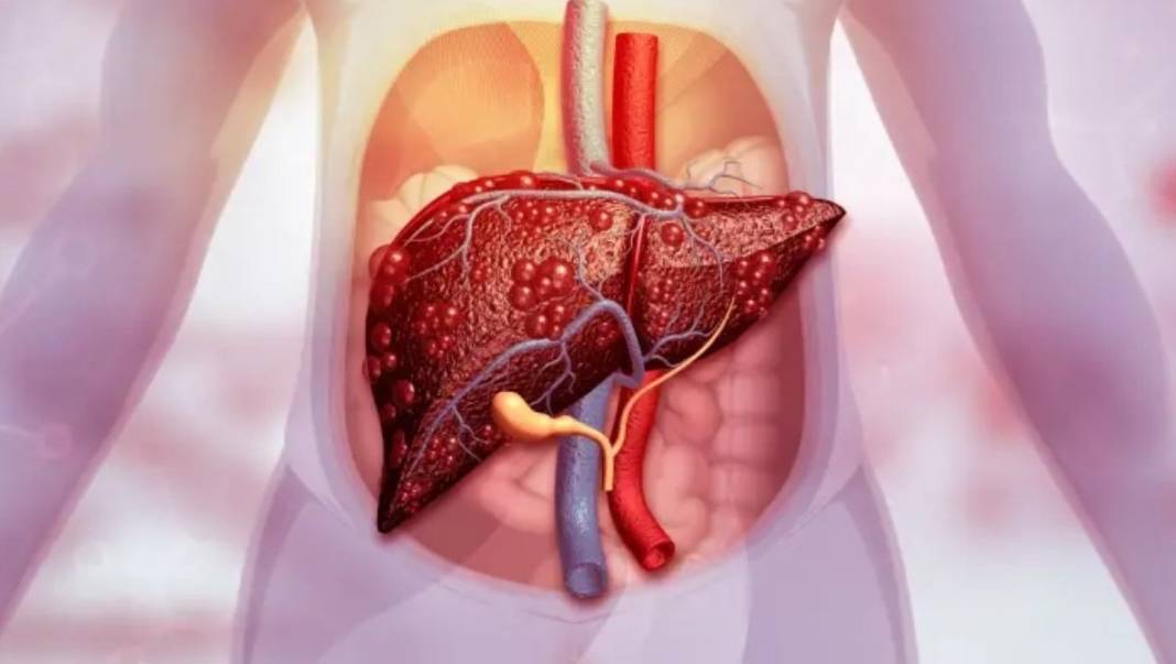 Faydalarını bilen günde bir bardak içiyor! 10