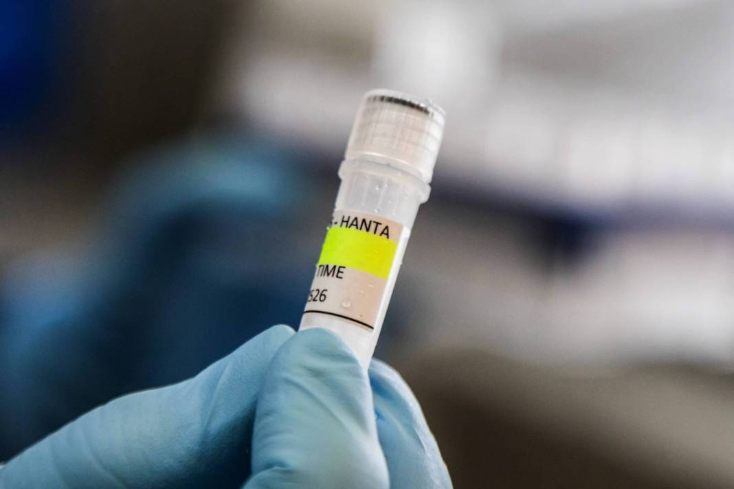 Hantavirüs, dünya için koronavirüs gibi bir tehdit mi? 14