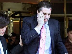 ABD’nin Güney Kore Elçisi Taburcu Oldu