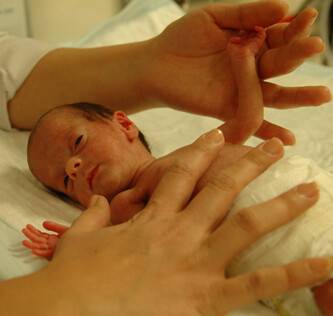 860 gram doğmuştu