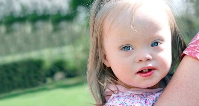 Torku Konyaspor'dan down sendromlu çocuklara destek