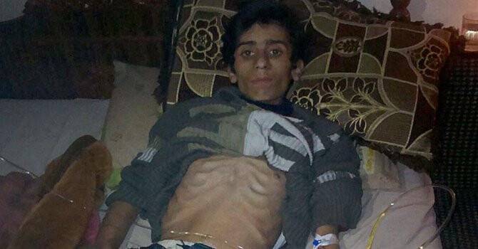 Madaya'da 2 kişi daha gıda yetersizliğinden hayatını kaybetti
