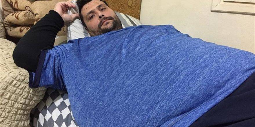 210 Kilogramlık Savaş Mağduru Tedavi Olmayı Bekliyor