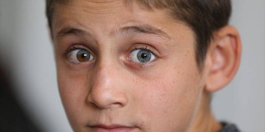 Bu Gözler Görenleri Şaşırtıyor