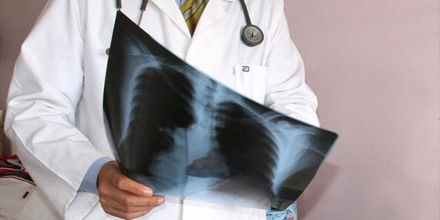 'Akciğer Kanseri Erkeklerde En Sık Görülen Kanser Türü'