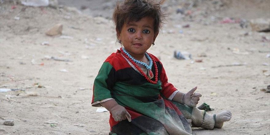 Afganistan'da Kalbi Delik 11 Bin Çocuk Tedavi Olmayı Bekliyor