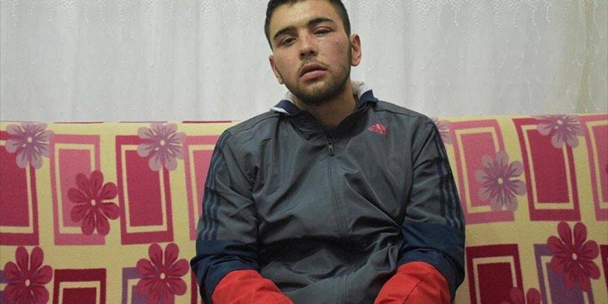 'Bir Gözüm Değil İki Gözüm Vatana Feda Olsun'