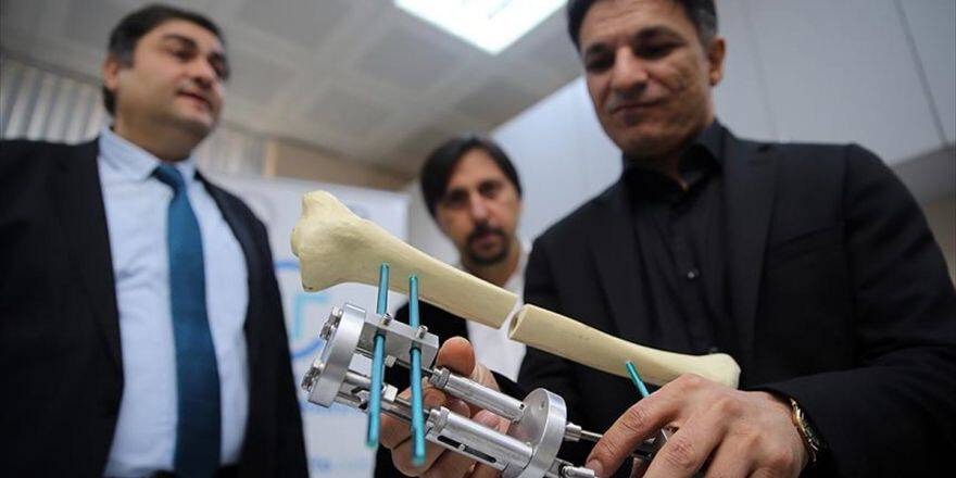 Kırıklarda 'Alçı'ya Son Verecekler
