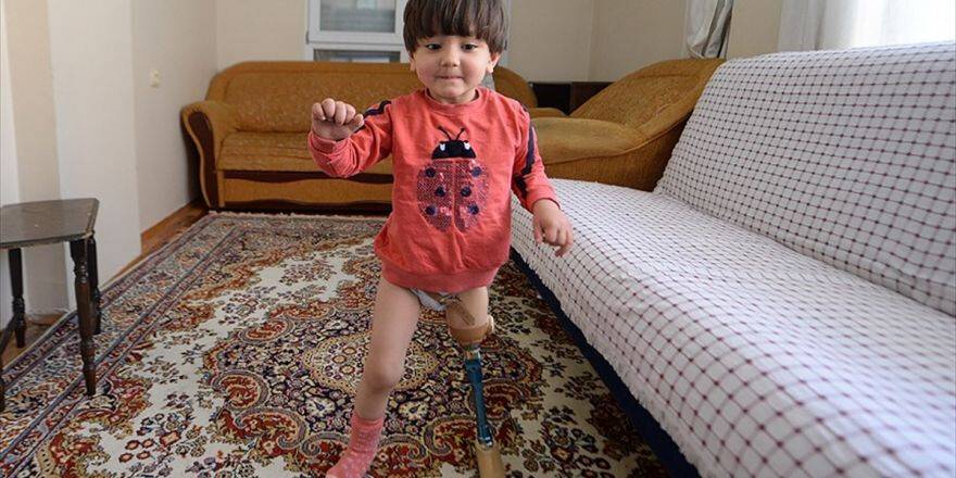 Kızına 150 Liraya Yaptığı Düzenekle Yürütmeyi Öğretti