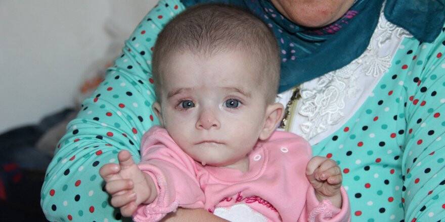 10 aylık Alime'nin bakışları yürek yakıyor