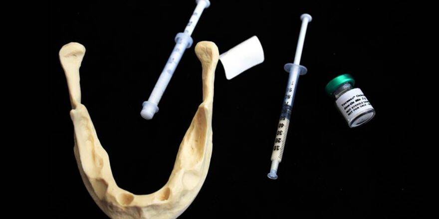 'Türkiye'de Yılda 400 Bin İmplant Yapılıyor'