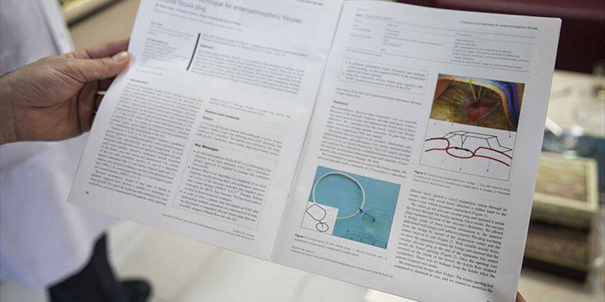 Türk Doktorun Buluşuna Abd'den Patent