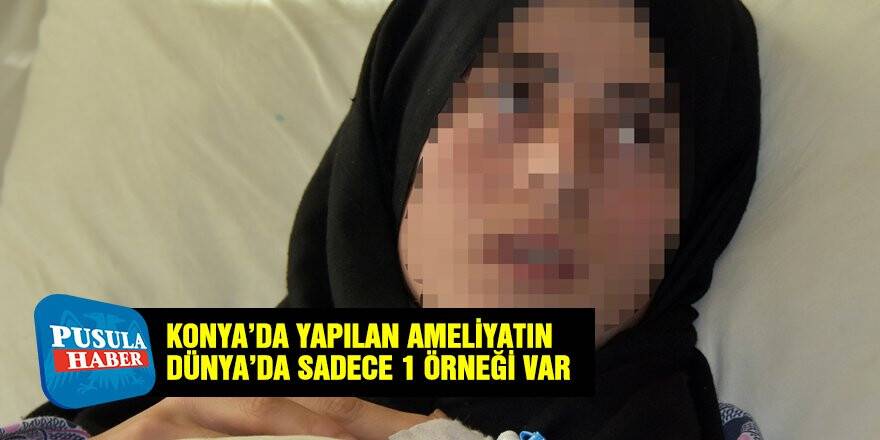 Konya'da yapılan bu ameliyatın Dünya'da sadece 1 örneği var