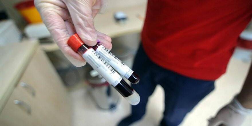 Kanseri Semptomlarından Önce Teşhis Edebilen Test Denendi
