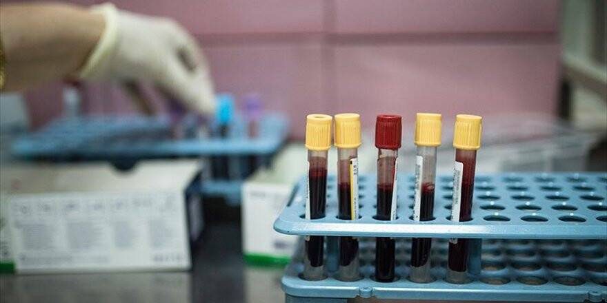 Türkiye Kanser Kaydında Yüzde 100'e Ulaştı