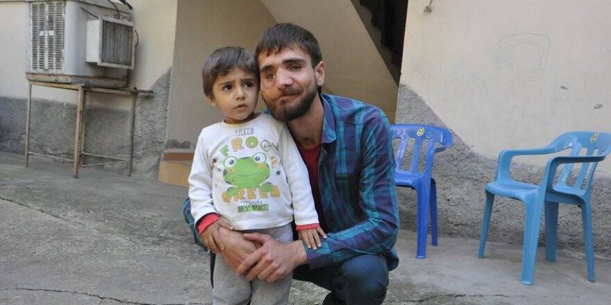 38 kez ameliyat oldu, yüzü düzelmedi