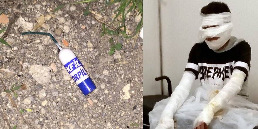 Çakmak tüpü ile torpil patlatan çocuklar yanarak hastanelik oldu