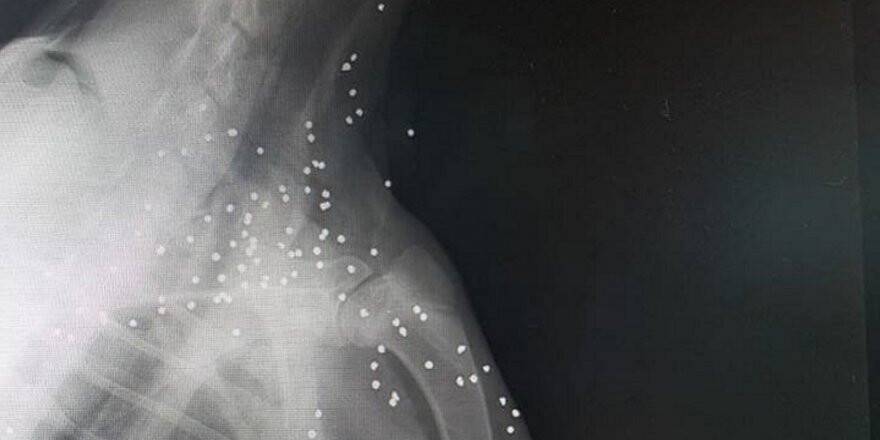 Köpeğin röntgenini gören şok oldu