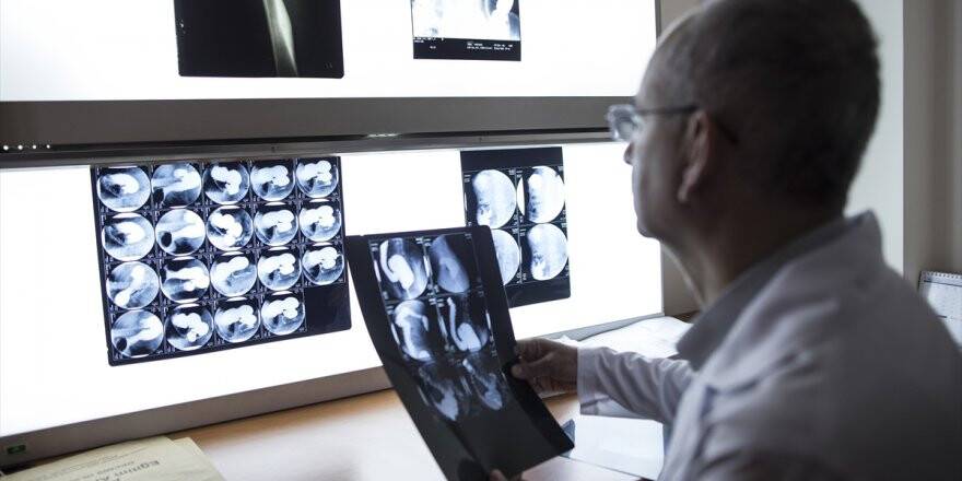 Renkli Ve 3 Boyutlu Röntgen İlk Kez İnsan Üzerinde Denendi