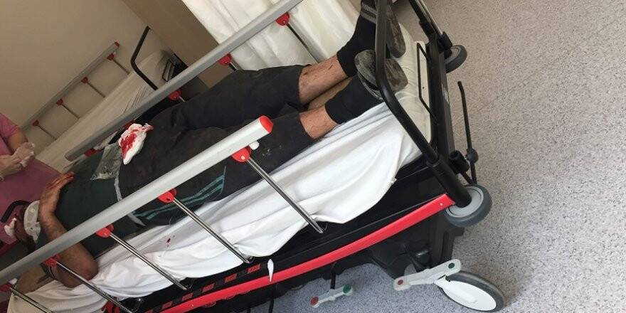 Patlayan lastik tamirciyi hastanelik etti