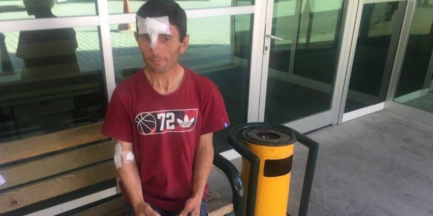 Kamyonetten yüklediği briketin üzerine devrilmesi sonucu yaralandı 