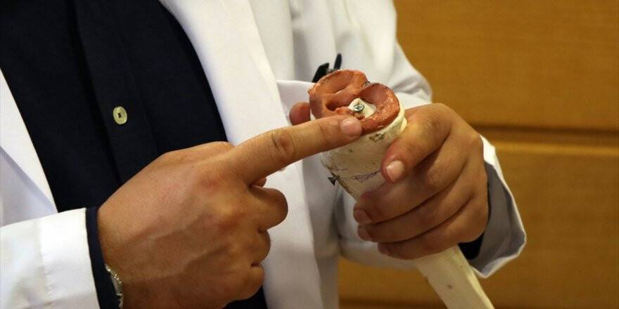 'Diz Cerrahisinde Dünya Standartlarındayız'