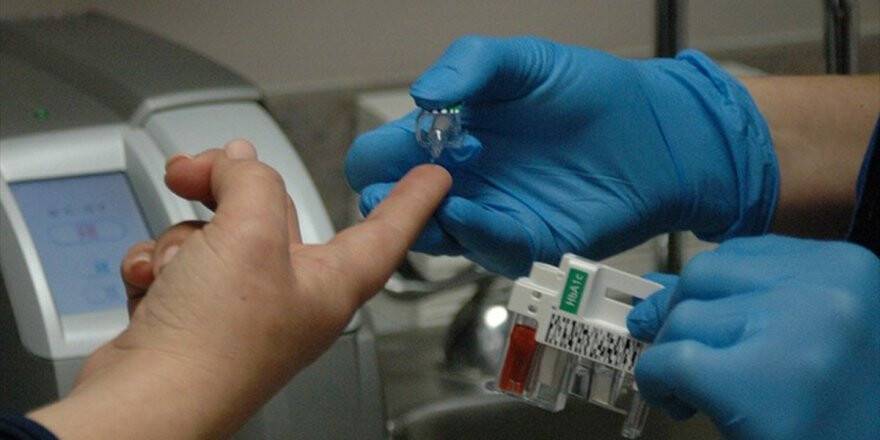 Diyabeti Bulunan 1 Milyon Kişi Kör Olma Riski Taşıyor