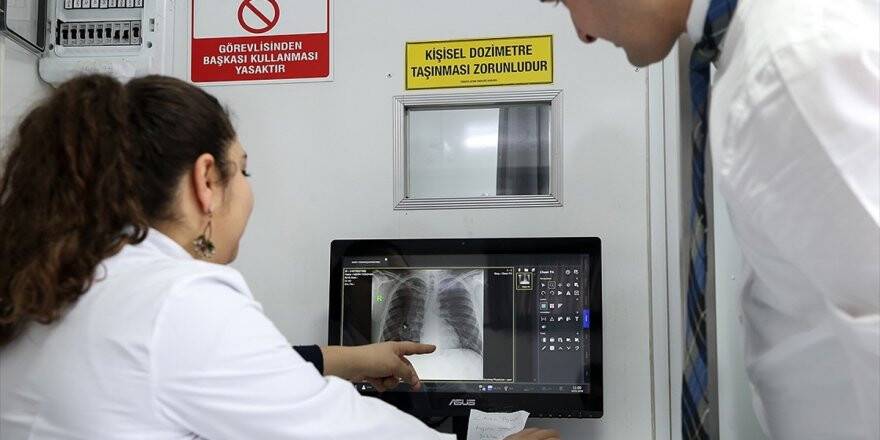 Türkiye'de Tüberküloz Ölüm Hızı Dünya Ortalamasının Altında