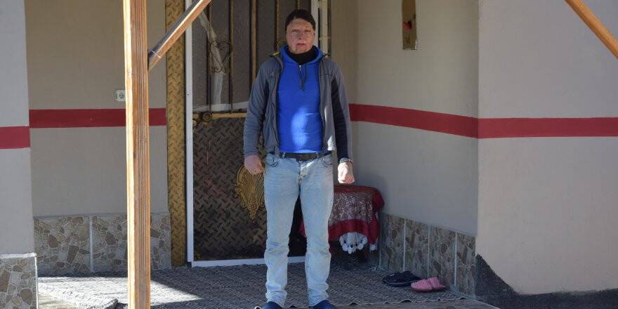 Yanık İzleri Nedeniyle Evden Çıkamayan Genç Yardım Bekliyor