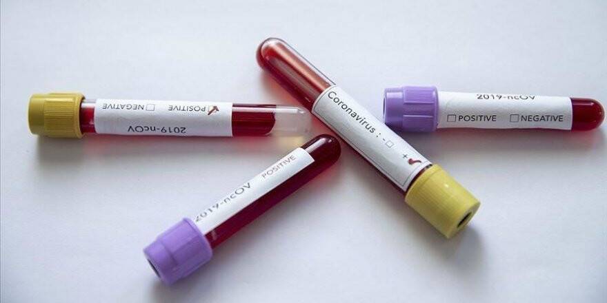 İran'da Sağlık Bakan Yardımcısı koronavirüse yakalandı