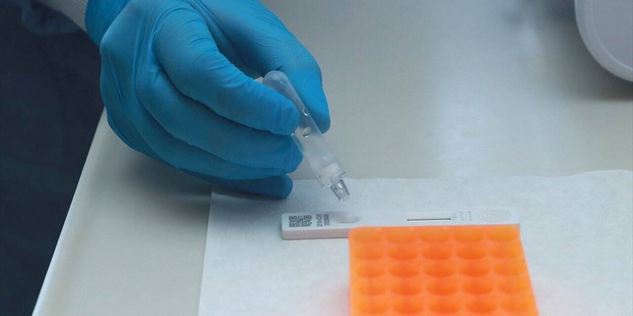 Türkiye'de 73 Merkez 'kovid-19 Tanı Laboratuvarı' Olarak Yetkilendirildi