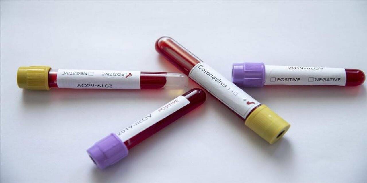 Dünya genelinde koronavirüsten ölenlerin sayısı 40 bini aştı