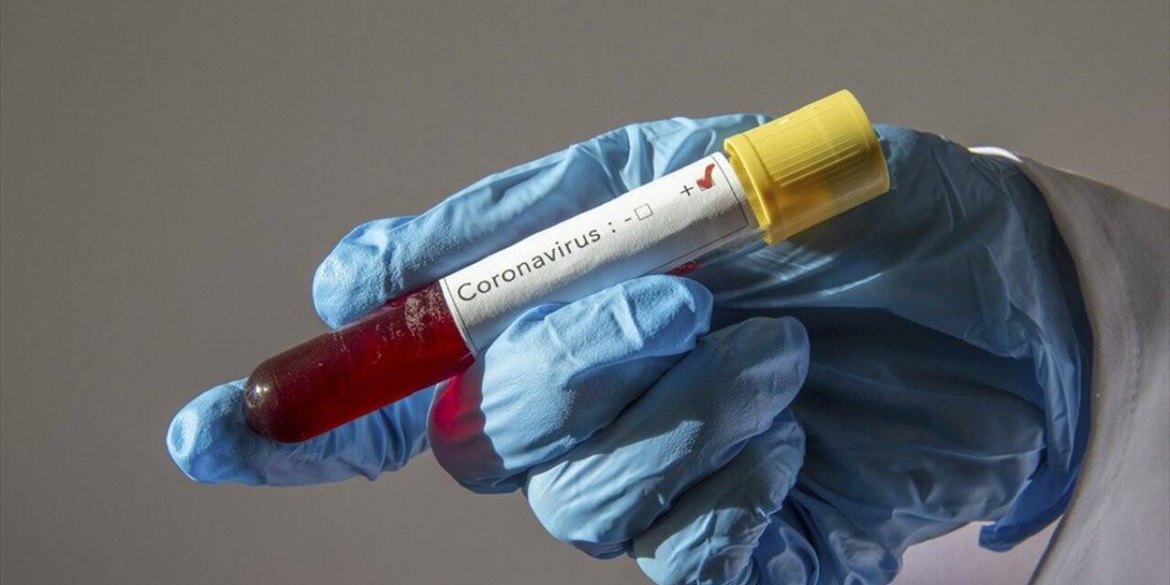 İsrail Sağlık Bakanı Litzman İle Eşinin Kovid-19 Testi Pozitif Çıktı