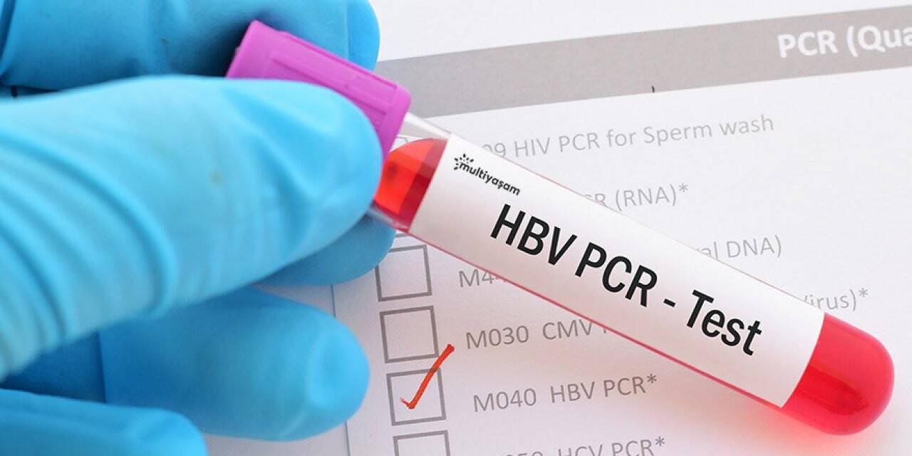 Koronavirüs teşhisinde PCR Testi nedir?