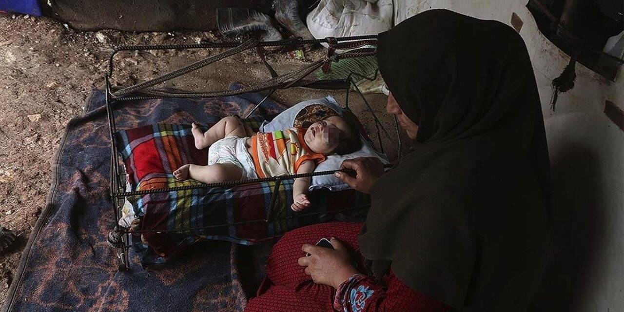 Suriyeli minik Yusuf ameliyat edilmezse gözünü kaybedecek