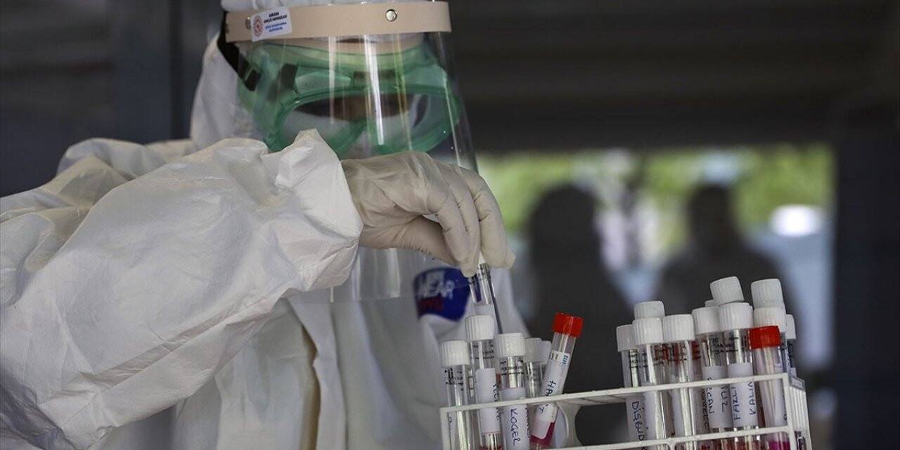 Başkentteki sanayi bölgelerinde çalışanlara Kovid-19 testi yapılmaya başlandı